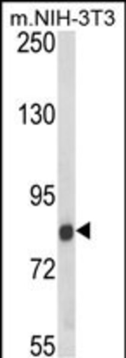 TARSL2 Polyclonal Antibody 400 &mu;L | Buy Online | Thermo Fisher Scientific | Fisher Scientific