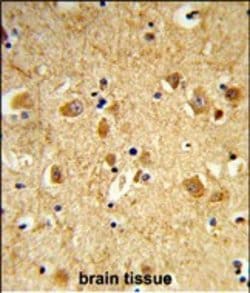 Dynamin 3 Polyclonal Antibody:Antibodies, Polyclonal