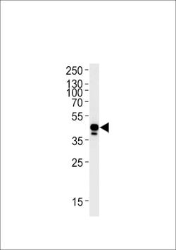 Invitrogen Ephrin B2 Polyclonal Antibody 400 μL; Unconjugated:Antibodies,