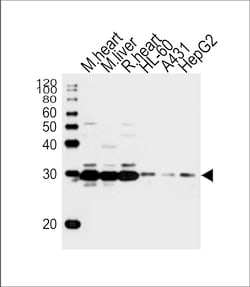 Invitrogen SDHB Polyclonal Antibody 400 &mu;L; Unconjugated:Antibodies,