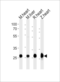 Invitrogen SDHB Polyclonal Antibody 400 &mu;L; Unconjugated:Antibodies,
