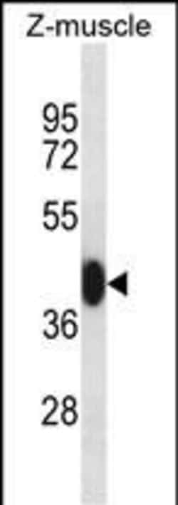 Invitrogen MEF2C Polyclonal Antibody 400 &mu;L | Buy Online | Invitrogen&trade; | Fisher Scientific
