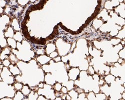 Invitrogen MTAP Polyclonal Antibody 100 &mu;L | Buy Online | Invitrogen&trade; | Fisher Scientific