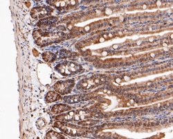 Invitrogen MTAP Polyclonal Antibody 100 &mu;L | Buy Online | Invitrogen&trade; | Fisher Scientific