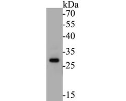 Invitrogen MTAP Polyclonal Antibody 100 &mu;L | Buy Online | Invitrogen&trade; | Fisher Scientific