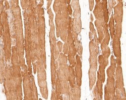 Invitrogen P2X6 Polyclonal Antibody 100 μL; Unconjugated:Antibodies,