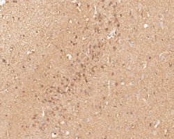 Invitrogen P2X6 Polyclonal Antibody 100 μL; Unconjugated:Antibodies,