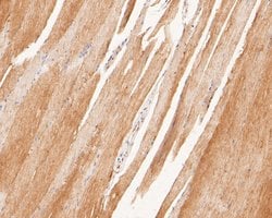 Invitrogen P2X6 Polyclonal Antibody 100 μL; Unconjugated:Antibodies,