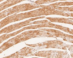 Invitrogen P2X6 Polyclonal Antibody 100 μL; Unconjugated:Antibodies,