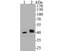 Invitrogen P2X6 Polyclonal Antibody 100 μL; Unconjugated:Antibodies,