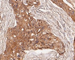 Invitrogen GABRB1 Polyclonal Antibody 100 &mu;L; Unconjugated:Antibodies,