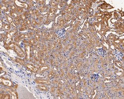 Invitrogen GABRB1 Polyclonal Antibody 100 &mu;L; Unconjugated:Antibodies,