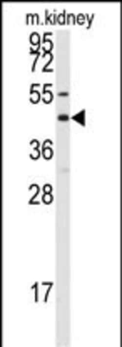 Invitrogen Connexin 50 Polyclonal Antibody 400 μL; Unconjugated:Antibodies,