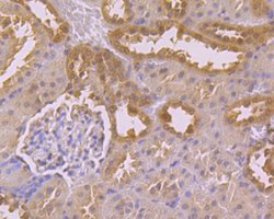 Invitrogen USP21 Polyclonal Antibody 100 &mu;L; Unconjugated:Antibodies,
