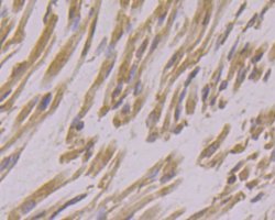 Invitrogen USP21 Polyclonal Antibody 100 &mu;L; Unconjugated:Antibodies,