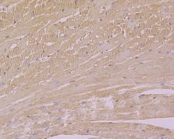 Invitrogen USP21 Polyclonal Antibody 100 &mu;L; Unconjugated:Antibodies,