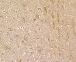 Invitrogen Fascin Polyclonal Antibody 100 &mu;L; Unconjugated:Antibodies,