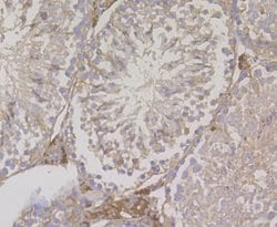 Invitrogen Fascin Polyclonal Antibody 100 &mu;L; Unconjugated:Antibodies,