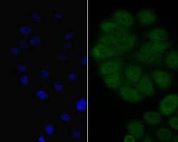 Invitrogen BCL6 Polyclonal Antibody 100 &mu;L; Unconjugated:Antibodies,