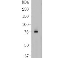 Invitrogen BCL6 Polyclonal Antibody 100 &mu;L; Unconjugated:Antibodies,