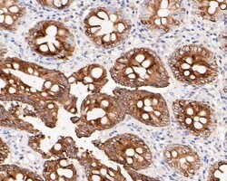 Invitrogen Cytokeratin 20 Polyclonal Antibody 100 &mu;L | Buy Online | Invitrogen&trade; | Fisher Scientific