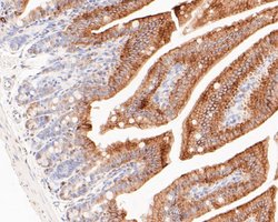 Invitrogen Cytokeratin 20 Polyclonal Antibody 100 &mu;L | Buy Online | Invitrogen&trade; | Fisher Scientific