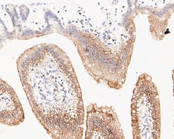 Invitrogen Cytokeratin 20 Polyclonal Antibody 100 &mu;L | Buy Online | Invitrogen&trade; | Fisher Scientific