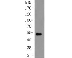 Invitrogen Cytokeratin 20 Polyclonal Antibody 100 &mu;L | Buy Online | Invitrogen&trade; | Fisher Scientific