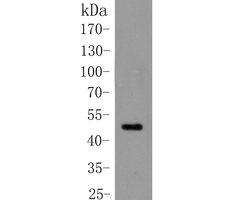 Invitrogen Cytokeratin 20 Polyclonal Antibody 100 &mu;L | Buy Online | Invitrogen&trade; | Fisher Scientific