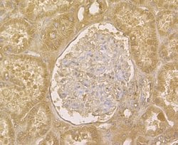 Invitrogen TRADD Polyclonal Antibody 100 &mu;L; Unconjugated:Antibodies,