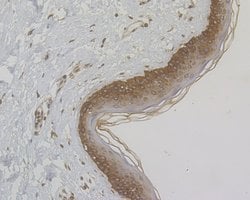 Invitrogen Cytokeratin 5/6 Polyclonal Antibody 100 &mu;L; Unconjugated:Antibodies,