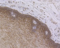 Invitrogen Cytokeratin 5/6 Polyclonal Antibody 100 &mu;L; Unconjugated:Antibodies,