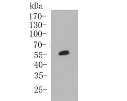 Invitrogen Cytokeratin 5/6 Polyclonal Antibody 100 &mu;L; Unconjugated:Antibodies,