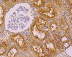 Invitrogen Folate Receptor alpha Polyclonal Antibody 100 &mu;L; Unconjugated:Antibodies,
