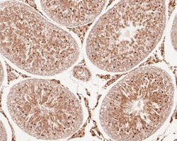 Invitrogen Fumarase Polyclonal Antibody 100 μL; Unconjugated:Antibodies,