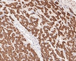 Invitrogen Fumarase Polyclonal Antibody 100 μL; Unconjugated:Antibodies,