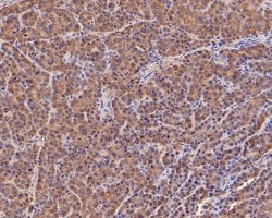 Invitrogen Fumarase Polyclonal Antibody 100 μL; Unconjugated:Antibodies,