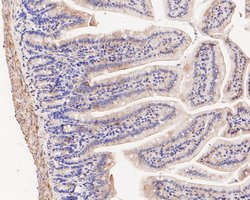 Invitrogen Fumarase Polyclonal Antibody 100 μL; Unconjugated:Antibodies,