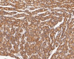 Invitrogen CHRNA3 Polyclonal Antibody 100 &mu;L; Unconjugated:Antibodies,