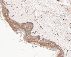 Invitrogen CHRNA3 Polyclonal Antibody 100 &mu;L; Unconjugated:Antibodies,