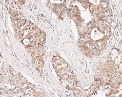 Invitrogen CHRNA3 Polyclonal Antibody 100 &mu;L; Unconjugated:Antibodies,