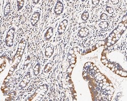 Invitrogen CHRNA3 Polyclonal Antibody 100 &mu;L; Unconjugated:Antibodies,