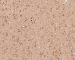 Invitrogen CHRNA3 Polyclonal Antibody 100 &mu;L; Unconjugated:Antibodies,