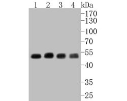 Invitrogen CHRNA3 Polyclonal Antibody 100 &mu;L; Unconjugated:Antibodies,