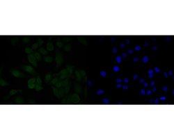 Invitrogen MDM2 Polyclonal Antibody 100 &mu;L; Unconjugated:Antibodies,