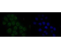 Invitrogen MDM2 Polyclonal Antibody 100 &mu;L; Unconjugated:Antibodies,