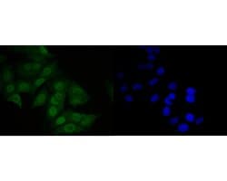 Invitrogen MDM2 Polyclonal Antibody 100 &mu;L; Unconjugated:Antibodies,
