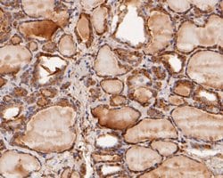 Invitrogen MDM2 Polyclonal Antibody 100 &mu;L; Unconjugated:Antibodies,