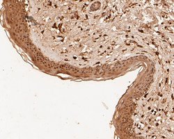 Invitrogen MDM2 Polyclonal Antibody 100 &mu;L; Unconjugated:Antibodies,