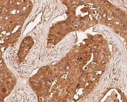 Invitrogen MDM2 Polyclonal Antibody 100 &mu;L; Unconjugated:Antibodies,